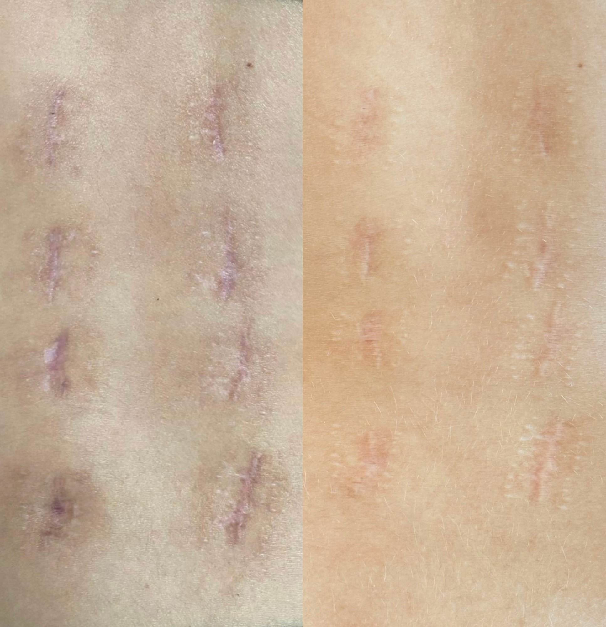 Skóra przed zabiegiem i po zabiegu, zdjęcie 18